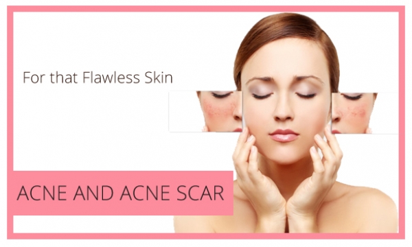 Small-Slider-Acne and Acne